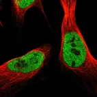 Immunofluorescent staining of human cell line U-2 OS shows localization to nucleoplasm.
