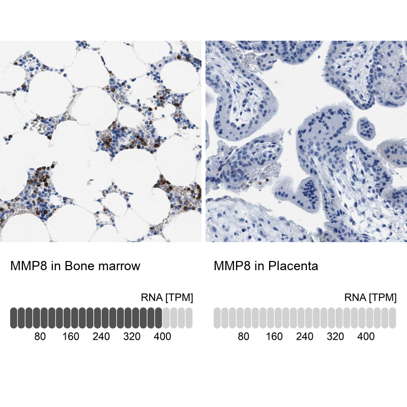 Anti-MMP8 Antibody