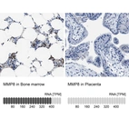 Anti-MMP8 Antibody