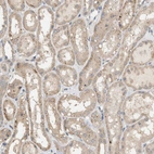 Immunohistochemical staining of human kidney shows weak cytoplasmic positivity in cells in tubules.
