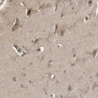 Immunohistochemical staining of human cerebral cortex shows moderate cytoplasmic positivity in neurons.