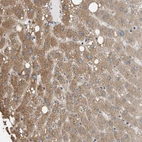 Immunohistochemical staining of human liver shows moderate cytoplasmic positivity in hepatocytes.