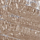 Immunohistochemical staining of human skeletal muscle shows moderate cytoplasmic positivity in myocytes.