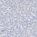 Anti-NMT1 Antibody
