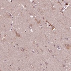 Immunohistochemical staining of human cerebral cortex shows high expression.