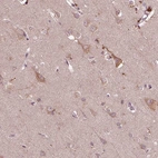 Immunohistochemical staining of human cerebral cortex shows high expression.