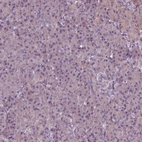 Immunohistochemical staining of human pancreas shows low expression as expected.