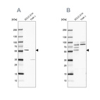 Western blot analysis using Anti-RUFY3 antibody HPA022952 (A) shows similar pattern to independent antibody HPA022970 (B).