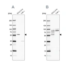 Western blot analysis using Anti-RUFY3 antibody HPA022952 (A) shows similar pattern to independent antibody HPA022970 (B).