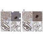 Anti-ACLY Antibody