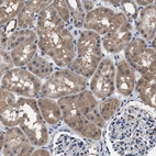 Immunohistochemical staining of human kidney shows moderate cytoplasmic positivity in cells in tubules.