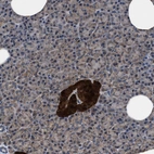 Immunohistochemical staining of human pancreas shows strong cytoplasmic positivity in islets of Langerhans.