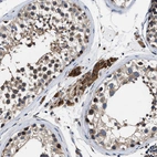 Immunohistochemical staining of human testis shows strong cytoplasmic positivity in Leydig cells.