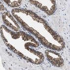Immunohistochemical staining of human prostate shows strong cytoplasmic positivity in glandular cells.