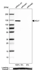 Western blot analysis in A-549 cells transfected with control siRNA, target specific siRNA probe #1 and #2, using Anti-ACLY antibody. Remaining relative intensity is presented. Loading control: Anti-GAPDH.
