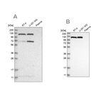 Anti-ACLY Antibody