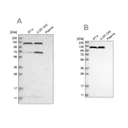 Western blot analysis using Anti-ACLY antibody HPA022953 (A) shows similar pattern to independent antibody HPA022434 (B).