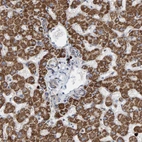 Anti-B9D1 Antibody