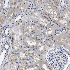 Immunohistochemical staining of human kidney shows weak cytoplasmic positivity in cells in tubules.