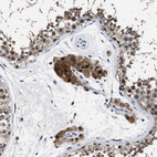 Immunohistochemical staining of human testis shows strong cytoplasmic positivity in Leydig cells.
