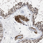 Immunohistochemical staining of human testis shows strong cytoplasmic positivity in Leydig cells.