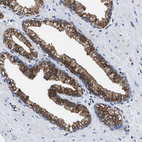 Immunohistochemical staining of human prostate shows moderate cytoplasmic positivity in glandular cells.