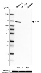 Western blot analysis in A-549 cells transfected with control siRNA, target specific siRNA probe #1 and #2, using Anti-ACLY antibody. Remaining relative intensity is presented. Loading control: Anti-GAPDH.