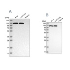 Western blot analysis using Anti-ACLY antibody HPA022959 (A) shows similar pattern to independent antibody HPA022434 (B).