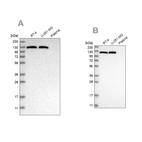 Western blot analysis using Anti-ACLY antibody HPA022959 (A) shows similar pattern to independent antibody HPA022434 (B).