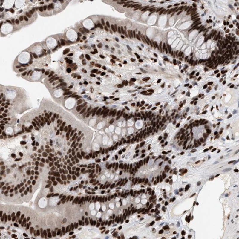Anti-C17orf49 Antibody