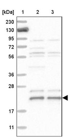 Lane 1: Marker [kDa] 230, 130, 95, 72, 56, 36, 28, 17, 11_br/_Lane 2: Human cell line RT-4_br/_Lane 3: Human cell line U-251MG sp