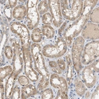 Immunohistochemical staining of human kidney shows moderate cytoplasmic positivity in cells in tubules.