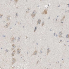 Immunohistochemical staining of human cerebral cortex shows moderate cytoplasmic positivity in neurons.