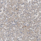 Immunohistochemical staining of human liver shows weak cytoplasmic positivity in hepatocytes.