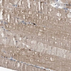 Immunohistochemical staining of human skeletal muscle shows moderate cytoplasmic positivity in myocytes.