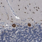 Immunohistochemical staining of human cerebellum shows moderate to strong cytoplasmic positivity in Purkinje cells and basket cells.