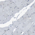 Immunohistochemical staining of human skeletal muscle shows no cytoplasmic positivity in myocytes as expected.