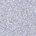 Immunohistochemical staining of human liver shows no positivity in hepatocytes as expected.