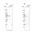 Western blot analysis using Anti-NMT1 antibody HPA022963 (A) shows similar pattern to independent antibody HPA022949 (B).
