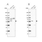 Western blot analysis using Anti-RUFY3 antibody HPA022970 (A) shows similar pattern to independent antibody HPA022952 (B).