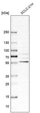 Western blot analysis in human cell line SCLC-21H.