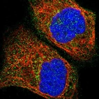 Immunofluorescent staining of human cell line A-431 shows localization to cytosol.
