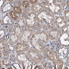 Immunohistochemical staining of human kidney shows weak granular cytoplasmic positivity in cells in tubules.