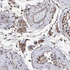 Immunohistochemical staining of human testis shows moderate cytoplasmic positivity in Leydig cells.