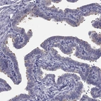 Immunohistochemical staining of human fallopian tube shows high expression.