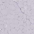 Immunohistochemical staining of human skeletal muscle shows low expression as expected.