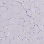 Anti-CCDC40 Antibody