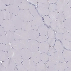Immunohistochemical staining of human skeletal muscle shows low expression as expected.