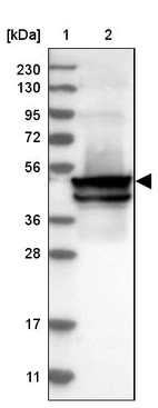 Lane 1: Marker [kDa] 230, 130, 95, 72, 56, 36, 28, 17, 11_br/_Lane 2: Human cell line RT-4