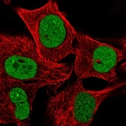 Immunofluorescent staining of human cell line SK-MEL-30 shows localization to nucleus & nucleoli.
